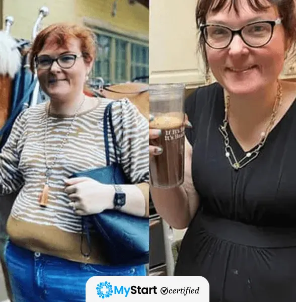 Before/After MyStart