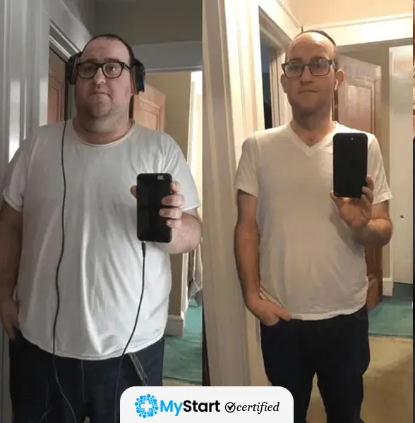 Before/After MyStart