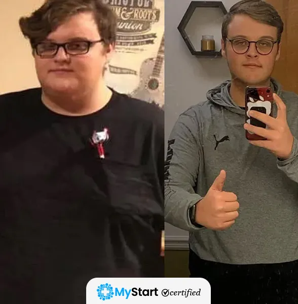 Before/After MyStart