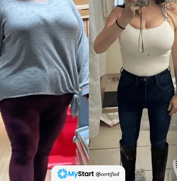 Before/After MyStart