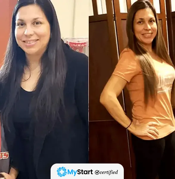 Before/After MyStart