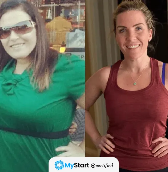 Before/After MyStart