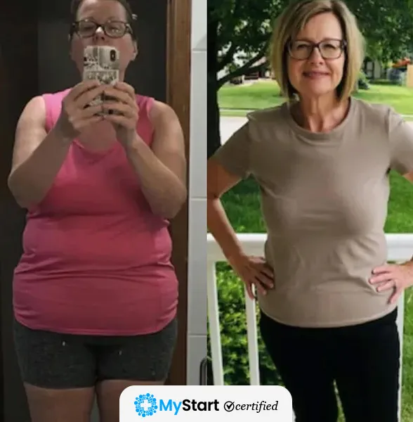 Before/After MyStart