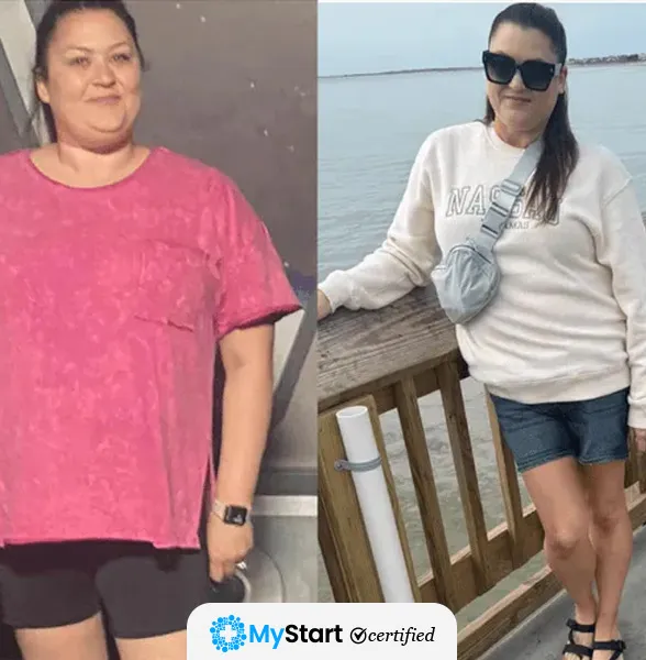 Before/After MyStart