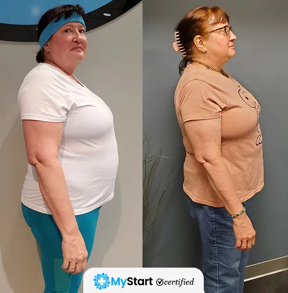 Before/After MyStart